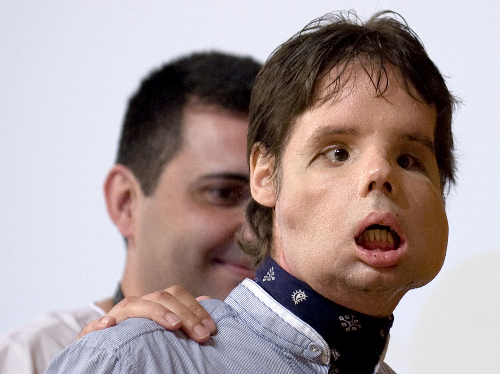 2010: Face Transplant
